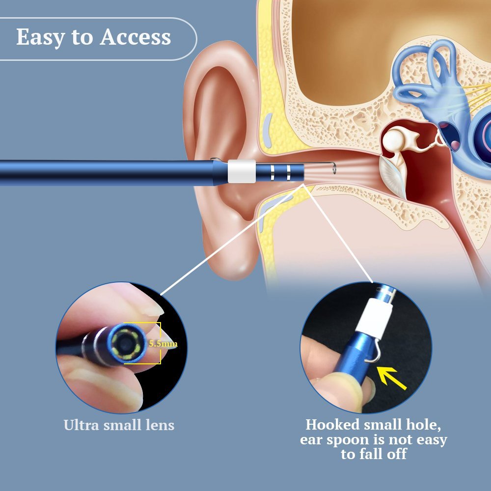 Умная ушная палочка (отоскоп, бороскоп, эндоскоп) для чистки ушей Beauty Star Ear Stick_5